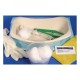 BV - Kit de Cateterização Vesical (13 sets) + 13 Seringas + 13 Géis